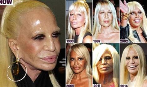 porque donatella versace é deformada|donatella versace clothing.